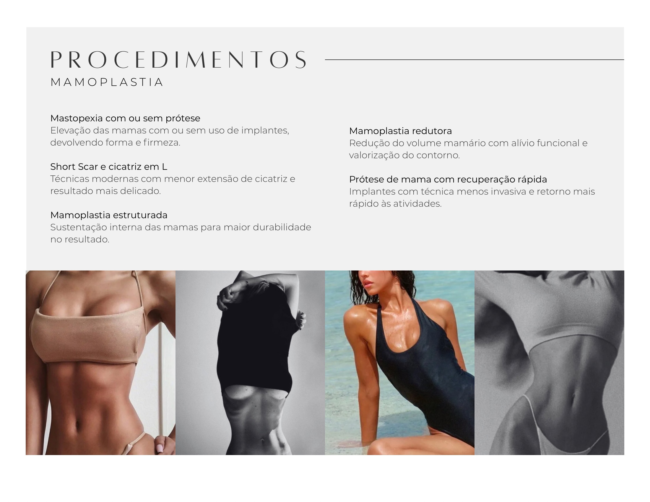 Mamoplastia